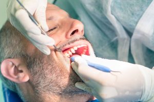 man getting tooth checked