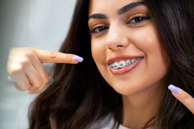 Young woman smiling and pointing to her colorful braces, showcasing orthodontic treatment options relevant to braces vs. Invisalign comparison at Noleen Dental.
