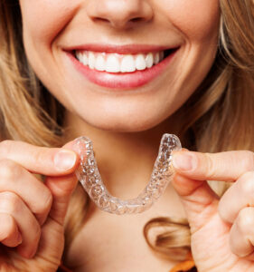 clear aligners